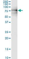 Anti-NUP98 Polyclonal Antibody Pair