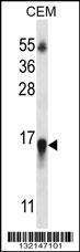 Anti-HIST1H2BN Rabbit Polyclonal Antibody (AP (Alkaline Phosphatase))