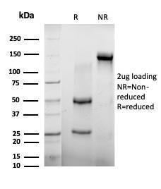 SDS-PAGE analysis of Anti-AGO3 Antibody [PCRP-AGO3-1C5] under non-reduced and reduced conditions; showing intact IgG and intact heavy and light chains, respectively SDS-PAGE analysis confirms the integrity and purity of the antibody