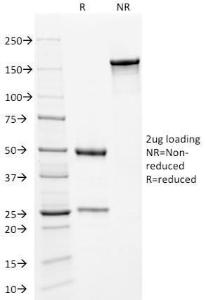 SDS-PAGE analysis of Anti-Kappa Light Chain Antibody [KLC709] under non-reduced and reduced conditions; showing intact IgG and intact heavy and light chains, respectively. SDS-PAGE analysis confirms the integrity and purity of the antibody