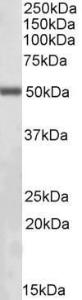 Anti-ILK Antibody (A83751) (0.5 µg/ml) staining of NIH3T3 lysate (35 µg protein in RIPA buffer). Primary incubation was 1 hour. Detected by chemiluminescence