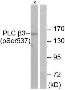 Western blot analysis of lysates from Jurkat cells treated with UV 15' using Anti-PLC beta3 (phospho Ser537) Antibody. The right hand lane represents a negative control, where the antibody is blocked by the immunising peptide