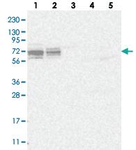 Anti-C17ORF104 Rabbit Polyclonal Antibody