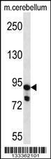 Anti-USP45 Rabbit Polyclonal Antibody (APC (Allophycocyanin))