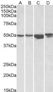 Anti-ILK Antibody (A83751) (1 µg/ml) staining of HEK293 (A), A431 (B), HeLa (C) and Jurkat (D) lysates (35 µg protein in RIPA buffer). Primary incubation was 1 hour. Detected by chemiluminescence