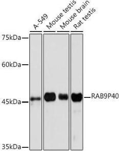 Anti-p40 Rabbit Monoclonal Antibody [clone: ARC2194]