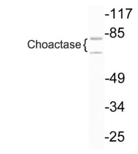 Western blot analysis of lysate from HepG2 cells using Anti-Choactase Antibody