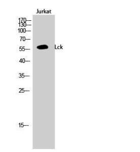 Western blot analysis of Jurkat cells using Anti-Lck Antibody