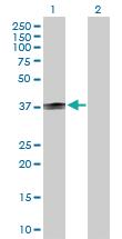 Anti-CD1B Rabbit Polyclonal Antibody