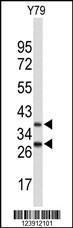 Anti-FBXO4 Rabbit Polyclonal Antibody (FITC (Fluorescein Isothiocyanate))