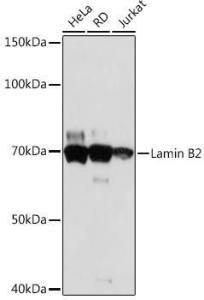 Western blot analysis of extracts of various cell lines, using Anti-Lamin B2 Antibody [ARC1252] (A309214) at 1:1000 dilution