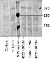 Anti-ATM Mouse Monoclonal Antibody [clone: 10H11.E12]