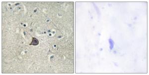 Immunohistochemical analysis of paraffin-embedded human brain using Anti-PLC beta3 (phospho Ser537) Antibody. The right hand panel represents a negative control, where the antibody was pre-incubated with the immunising peptide