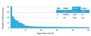 Analysis of protein array containing more than 19000 full-length human proteins using Anti-Kappa Light Chain Antibody [KLC709]