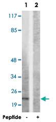 Anti-SDC4 Rabbit Polyclonal Antibody