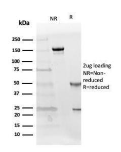 SDS-PAGE analysis of Anti-Follistatin Antibody [FST/4281] under non-reduced and reduced conditions; showing intact IgG and intact heavy and light chains, respectively. SDS-PAGE analysis confirms the integrity and purity of the antibody.