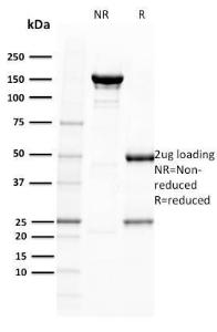 SDS-PAGE analysis of Anti-BOB1 Antibody [BOB1/2422] under non-reduced and reduced conditions; showing intact IgG and intact heavy and light chains, respectively. SDS-PAGE analysis confirms the integrity and purity of the antibody.