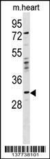 Anti-OTP Rabbit Polyclonal Antibody (Biotin)