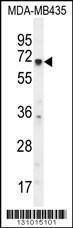 Anti-KCNQ1 Rabbit Polyclonal Antibody (Biotin)