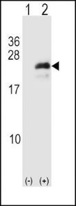 Anti-NEUROG3 Rabbit Polyclonal Antibody (Biotin)