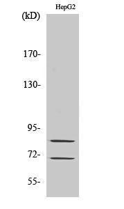 Western blot analysis of various cells using Anti-Choactase Antibody