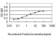 Anti-NPC1 Mouse Monoclonal Antibody [clone: 4H2]