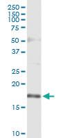 Anti-TSC22D1 Polyclonal Antibody Pair