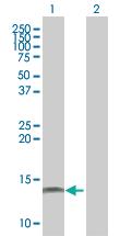 Anti-NPHP1 Mouse Polyclonal Antibody