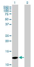 Anti-PFN4 Mouse Polyclonal Antibody