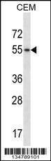 Anti-HCK Rabbit Polyclonal Antibody (FITC (Fluorescein Isothiocyanate))