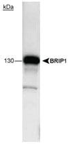 Anti-BRIP1 Mouse Monoclonal Antibody [clone: pp15-IB4]