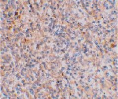 Anti-XAF1 Rabbit Polyclonal Antibody