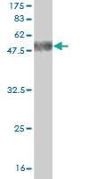 Anti-CIDEA Mouse Monoclonal Antibody [clone: 4B9]