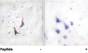 Anti-SDC4 Rabbit Polyclonal Antibody