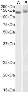 Anti-DDB1 Antibody (A83757) (0.01µg/ml) staining of NIH3T3 (A) and NSO (B) lysate. (35µg protein in RIPA buffer). Primary incubation was 1 hour. Detected by chemiluminescence.