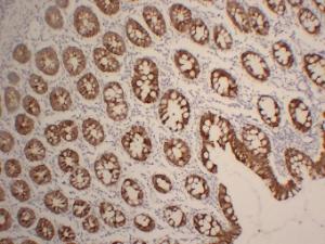 Immunohistochemical analysis of paraffin-embedded human Colon using Anti-Cytokeratin 19 Antibody