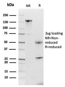 SDS-PAGE analysis of Anti-Lactoferrin Antibody [LTF/4079] under non-reduced and reduced conditions; showing intact IgG and intact heavy and light chains, respectively. SDS-PAGE analysis confirms the integrity and purity of the antibody