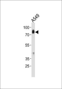 Anti-HCK Rabbit Polyclonal Antibody (APC (Allophycocyanin))