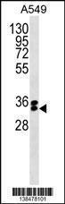 Anti-FBXO44 Rabbit Polyclonal Antibody