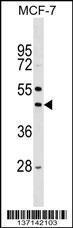 Anti-STK32A Rabbit Polyclonal Antibody (FITC (Fluorescein Isothiocyanate))