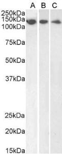 Anti-DDB1 Antibody (A83757) (1µg/ml) staining of HeLa (A), HepG2 (B) and Jurkat (C) lysate (35µg protein in RIPA buffer). Primary incubation was 1 hour. Detected by chemiluminescence.