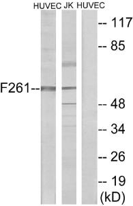 Antibody anti-PFKFB1 100 µg