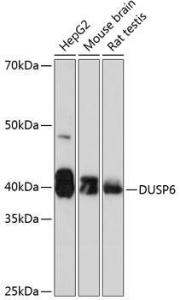 Western blot analysis of extracts of various cell lines, using Anti-DUSP6 Antibody [ARC0237] (A305412) at 1:1000 dilution. The secondary Antibody was Goat Anti-Rabbit IgG H&L Antibody (HRP) at 1:10000 dilution