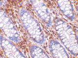 Anti-HTRA2 Rabbit Polyclonal Antibody