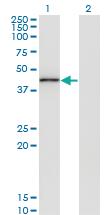 Anti-TRIB3 Mouse Monoclonal Antibody [clone: 3D7]