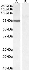 Anti-PPP1R15A Antibody (A83758) (0.3 µg/ml) staining of HepG2 (A) and negative control KLY (B) lysate (35 µg protein in RIPA buffer) Detected by chemiluminescence