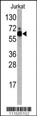 Anti-S6K (RPS6KB1) Rabbit Polyclonal Antibody