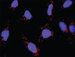 Anti-MAP3K14 + CHUK Antibody Pair