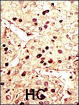 Anti-AURKB Rabbit Polyclonal Antibody (Biotin)