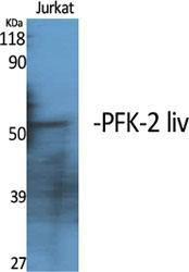 Antibody anti-PFKFB1 100 µg